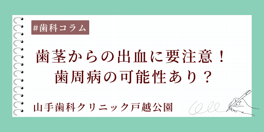 歯茎からの出血に要注意！ 歯周病の可能性あり？